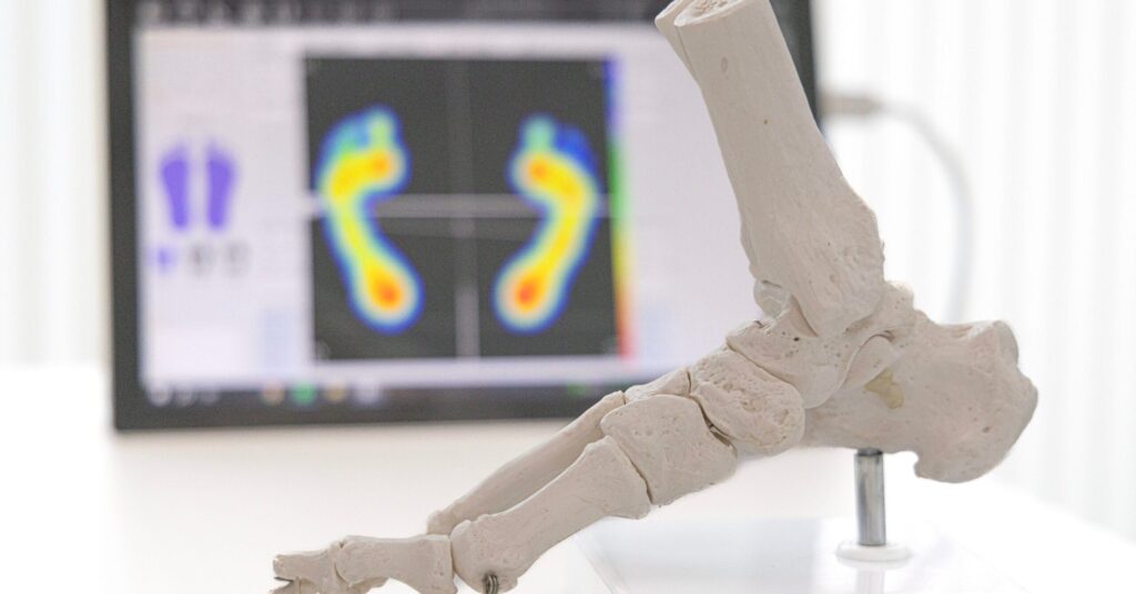 Estudio biomecánico en Fisiomove Cerdanyola del Vallès