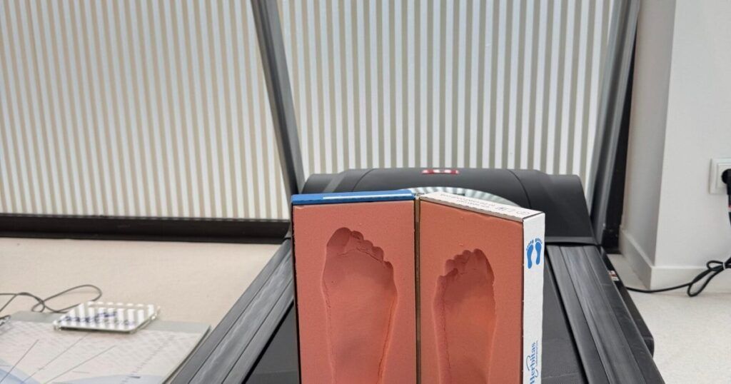 Plantillas personalizadas a medida sobre cinta de correr, podología y biomecánica, Fisiomove Cerdanyola del Vallès